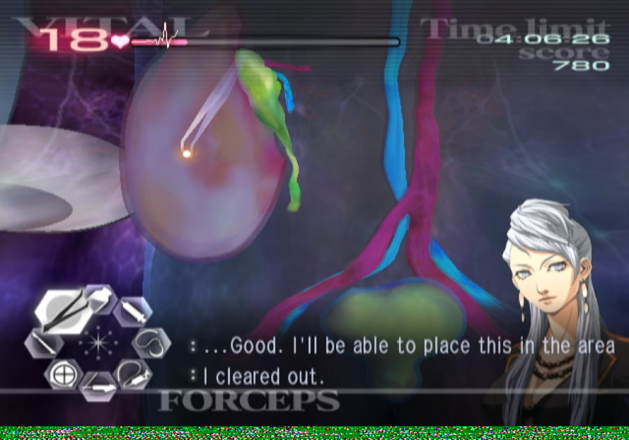 Trauma Center: Second Opinion Screenshot