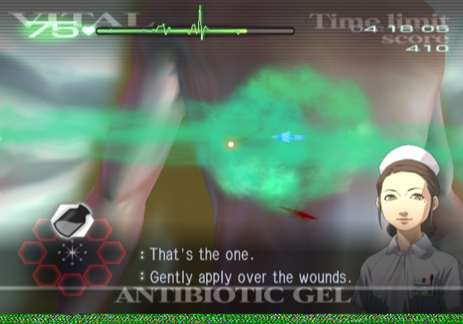 Trauma Center: Second Opinion Screenshot