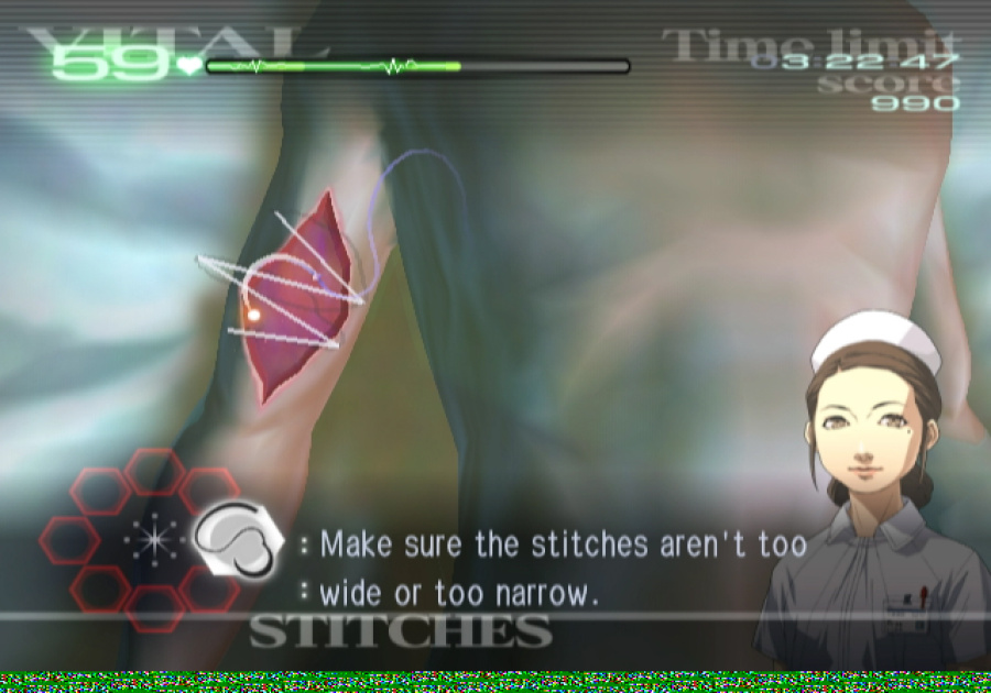 Trauma Center: Second Opinion Screenshot